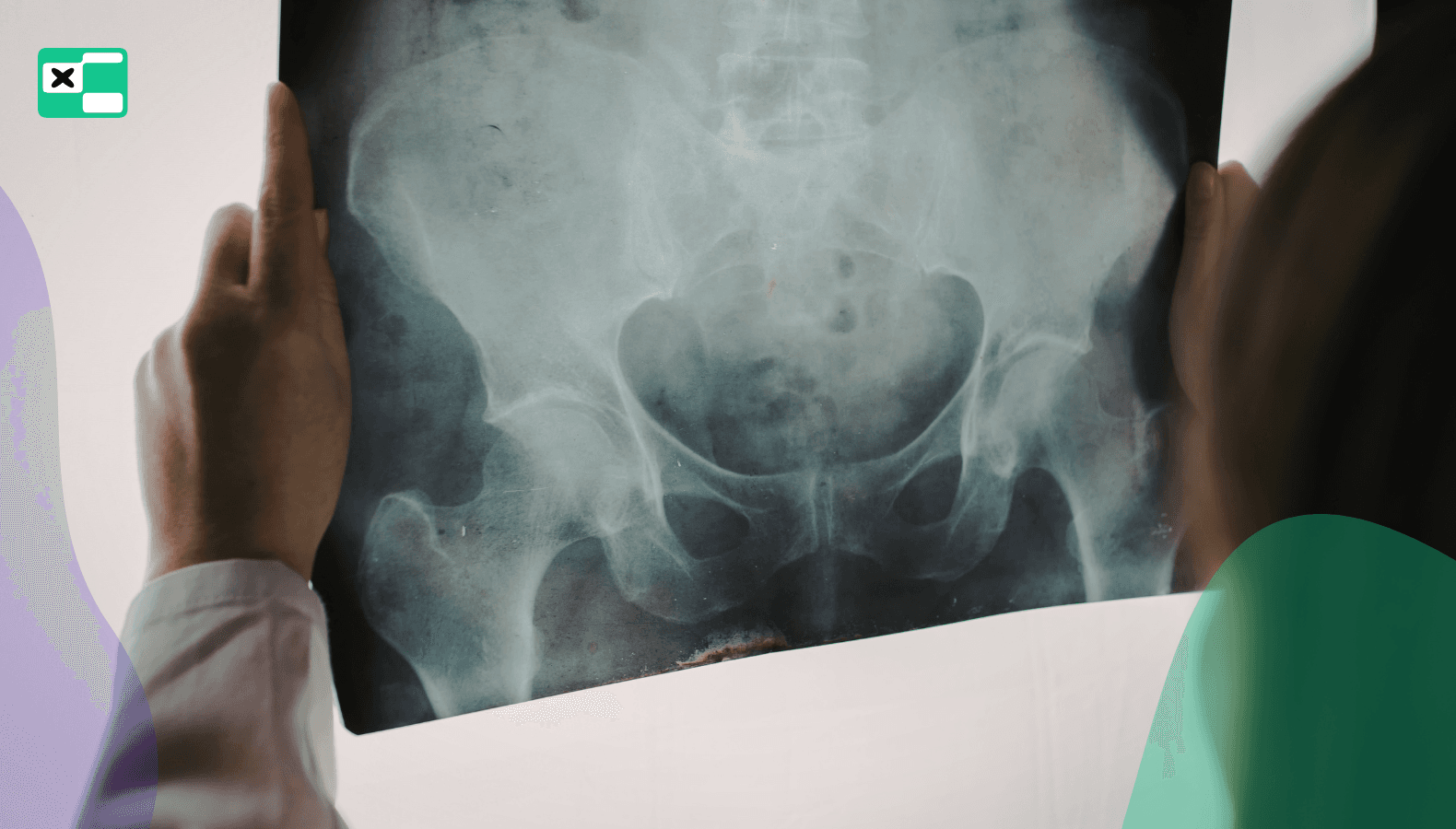 Mobilność bioder i kostek: Prewencja kontuzji, której triathloniści nie robią